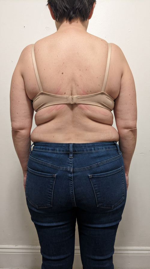Vorher (Model)