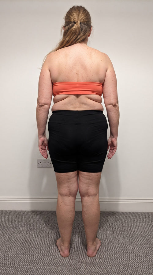 Vorher (Model)