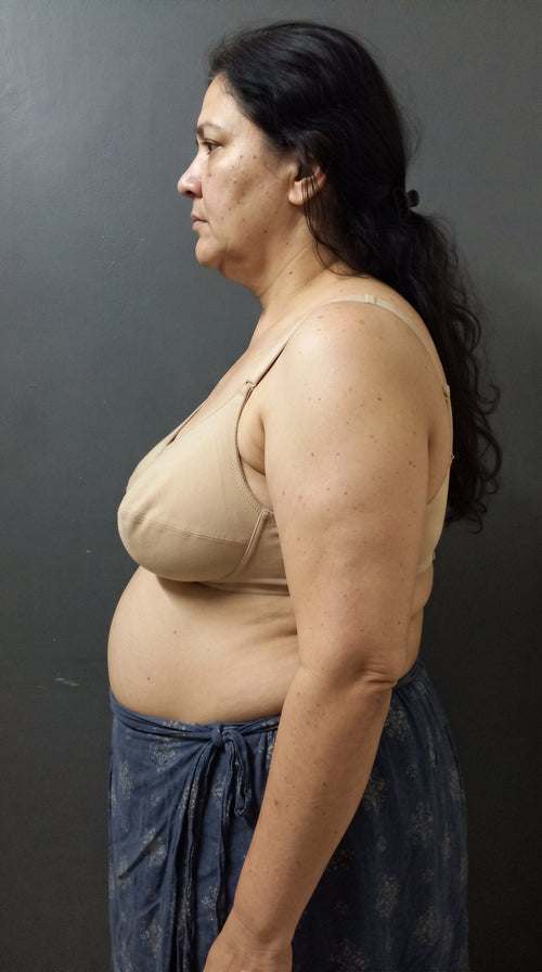Vorher (Model)